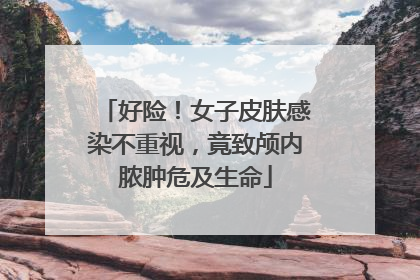 好险！女子皮肤感染不重视，竟致颅内脓肿危及生命